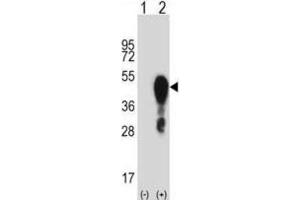 Western Blotting (WB) image for anti-Homeobox A1 (HOXA1) antibody (ABIN2998004) (HOXA1 Antikörper)