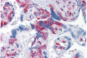 Human Placenta: Formalin-Fixed, Paraffin-Embedded (FFPE) (G3BP1 Antikörper  (AA 214-303))