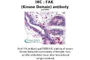 Image no. 1 for anti-PTK2 Protein tyrosine Kinase 2 (PTK2) antibody (ABIN1734244) (FAK Antikörper)