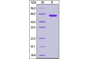 Human CD2, Fc Tag on  under reducing (R) condition. (CD2 Protein (CD2) (AA 25-209) (Fc Tag))