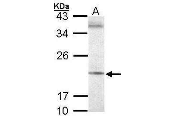 SEC61G anticorps  (Center)