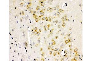 IHC-P: GLUR2 antibody testing of rat brain tissue (GRIA2 Antikörper  (AA 25-360))