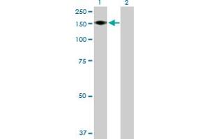 Western Blot analysis of ADAMTS18 expression in transfected 293T cell line by ADAMTS18 MaxPab polyclonal antibody.
