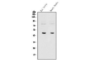 Western blot analysis of SOX3 using anti-SOX3 antibody (ABIN7600935).