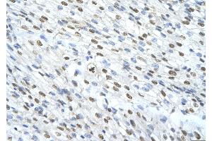 Rabbit Anti-MATR3 Antibody       Paraffin Embedded Tissue:  Human cardiac cell   Cellular Data:  Epithelial cells of renal tubule  Antibody Concentration:   4.