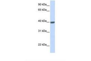 Image no. 1 for anti-Melanoma Antigen Family A, 1 (Directs Expression of Antigen MZ2-E) (MAGEA1) (AA 38-87) antibody (ABIN6749734) (MAGEA1 Antikörper  (AA 38-87))