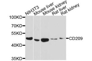 Western blot analysis of extracts of various cell lines, using CD209 antibody. (DC-SIGN/CD209 Antikörper  (AA 265-404))