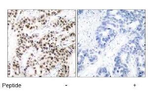 Image no. 2 for anti-Myc Proto-Oncogene protein (MYC) (Thr58) antibody (ABIN197155) (c-MYC Antikörper  (Thr58))