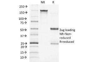 SDS-PAGE Analysis Purified ACTH Monoclonal Antibody (CLIP/1449). (POMC Antikörper  (AA 25-39))