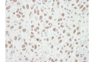Immunohistochemistry (IHC) image for anti-Minichromosome Maintenance Complex Component 6 (MCM6) (C-Term) antibody (ABIN7448656) (MCM6 Antikörper  (C-Term))