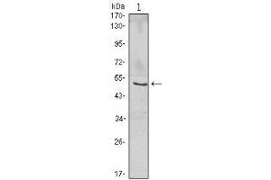 Western Blot showing NFKBIB antibody used against Jurkat (1) cell lysate. (NFKBIB Antikörper)