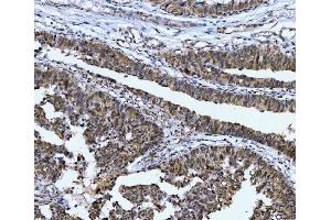 IHC analysis of CSNK2K2 using anti-CSNK2K2 antibody (ABIN7602871). (CSNK2A2 Antikörper  (C-Term))