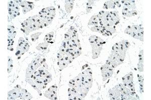 RBM22 antibody was used for immunohistochemistry at a concentration of 4-8 ug/ml to stain Skeletal muscle cells (arrows) in Human Muscle. (RBM22 Antikörper  (C-Term))