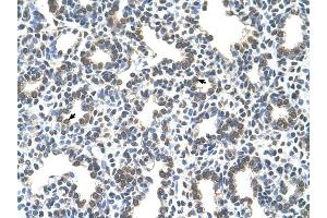 SLC43A3 antibody was used for immunohistochemistry at a concentration of 4-8 ug/ml to stain Alveolar cells (arrows) in Human Lung. (SLC43A3 Antikörper  (N-Term))