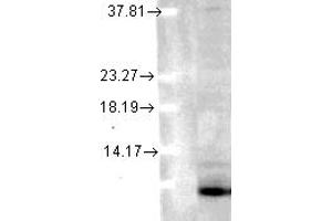 SMC 171, Ubiquitin (6C11 B3), human cvell line mix copy. (Ubiquitin Antikörper)