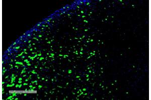 Immunohistochemistry analysis using Mouse Anti-Hexanoyl-Lysine adduct Monoclonal Antibody, Clone 5D9 (ABIN5067236). (Hexanoyl-Lysine Adduct (HEL) Antikörper (Atto 390))
