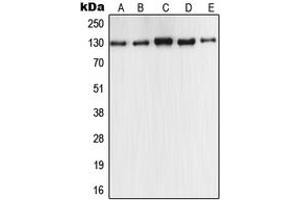 Western blot analysis of iNOS expression in MCF7 (A), A549 (B), Raw264. (NOS2 Antikörper  (C-Term))