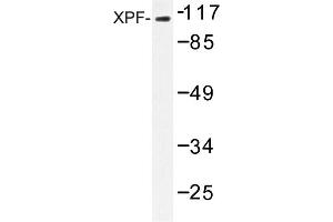 Image no. 1 for anti-Excision Repair Cross-Complementing Rodent Repair Deficiency, Complementation Group 4 (ERCC4) antibody (ABIN272306) (ERCC4 Antikörper)