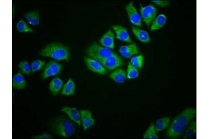 Immunofluorescence staining of Hela cells with ABIN7169831 at 1:166, counter-stained with DAPI. (SCIMP Antikörper  (AA 59-145))