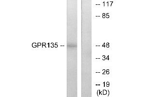 Western blot analysis of extracts from NIH-3T3 cells, using GPR135 antibody.