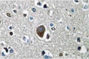 Immunohistochemistry analysis of AKAP149 Antibody in paraffin-embedded human brain tissue. (AKAP1 Antikörper)