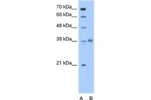 WB Suggested Anti-ALDOC Antibody Titration:  0. (ALDOC Antikörper  (N-Term))