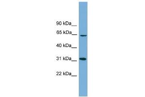 WB Suggested Anti-HSD17B11 Antibody Titration: 0. (HSD17B11 Antikörper  (N-Term))
