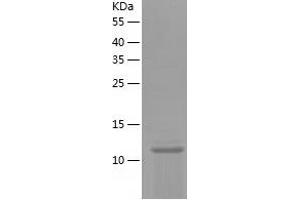 Western Blotting (WB) image for Cystatin SN (CST1) (AA 21-141) protein (His tag) (ABIN7122558)