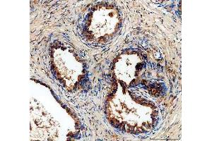 IHC analysis of ALDH1A3 using anti-ALDH1A3 antibody (ABIN5518802). (ALDH1A3 Antikörper  (AA 37-154))