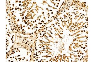 ABIN7094385 and ABIN7098432 at 1/100 staining Rat testis tissue by IHC-P. (NDOR1 Antikörper  (N-Term))