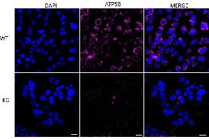Immunocytochemical staining of HeLa cells using ATP5B antibody (ABIN7797681), 1:1,000), Top panel: wild-type (WT), Bottom panal: ATP5B shRNA knockdown (KD).