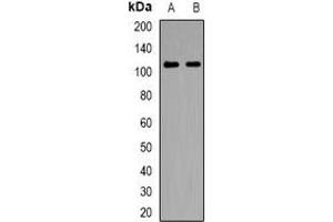 Western blot analysis of NLRX1 expression in HepG2 (A), Hela (B) whole cell lysates. (NLRX1 Antikörper)