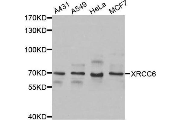 XRCC6 Antikörper  (AA 500-600)