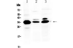 Western blot analysis of IL-1 beta using anti-IL-1 beta antibody .