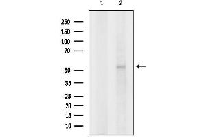 anti-Glycine Receptor, alpha 2 (GLRa2) (N-Term) antibody