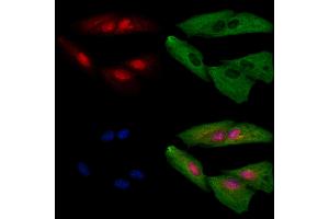 ABIN6259182 and ABIN6273697 staining  cells by IF/ICC. (SAP130 Antikörper  (C-Term))