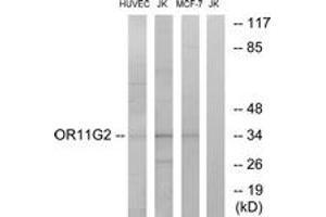 Western blot analysis of extracts from HuvEc/Jurkat/MCF-7 cells, using OR11G2 Antibody. (OR11G2 Antikörper  (AA 241-290))