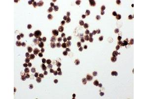 ICC testing of WISP1 antibody and MCF-7 cells (WISP1 Antikörper  (C-Term))