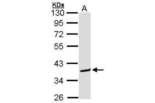 BCL2L12 Antikörper  (C-Term)