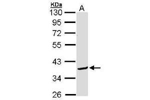 WB Image Sample (30 ug of whole cell lysate) A: Molt-4 , 10% SDS PAGE antibody diluted at 1:1000 (BCL2L12 Antikörper  (C-Term))