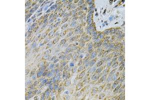 Immunohistochemistry of paraffin-embedded human esophagus using  Antibody (ABIN6127328, ABIN6136696, ABIN6136697 and ABIN6217467) at dilution of 1:100 (40x lens). (Adenylate Kinase 1 Antikörper  (AA 1-194))