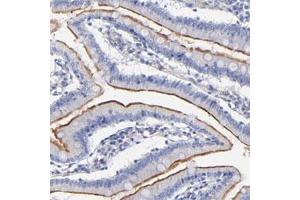 Immunohistochemical staining of human small intestine with SLC44A2 polyclonal antibody  shows membranous positivity in glandular cells. (SLC44A2 Antikörper)