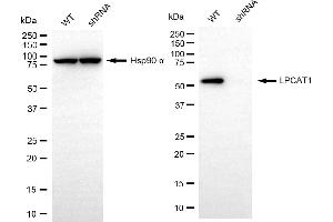 Western blotting analysis using LPCAT1 antibody (ABIN7799305). (Rekombinanter LPCAT1 Antikörper)