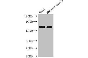 Western Blot Positive WB detected in: Mouse heart tissue, Mouse skeletal muscle tissue All lanes: CES1 antibody at 5 μg/mL Secondary Goat polyclonal to rabbit IgG at 1/50000 dilution Predicted band size: 63 kDa Observed band size: 63 kDa