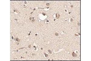 Immunohistochemistry of Slitrk3 in human brain tissue with this product at 2.
