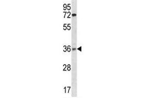 XRCC2 antibody western blot analysis in ZR-75-1 lysate (XRCC2 Antikörper  (AA 1-30))