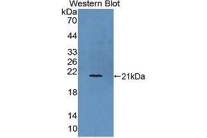 Western Blotting (WB) image for anti-Collagen, Type VI, alpha 3 (COL6a3) (AA 463-624) antibody (ABIN1867320)