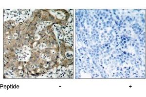 Image no. 2 for anti-Forkhead Box O1 (FOXO1) (Ser319) antibody (ABIN197367) (FOXO1 Antikörper  (Ser319))