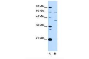 Image no. 2 for anti-Replication Factor C (Activator 1) 5, 36.5kDa (RFC5) (N-Term) antibody (ABIN6738219) (RFC5 Antikörper  (N-Term))
