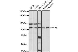 Western blot analysis of extracts of various cell lines, using DDX51 antibody (ABIN7266699) at 1:1000 dilution. (DDX51 Antikörper  (AA 367-666))